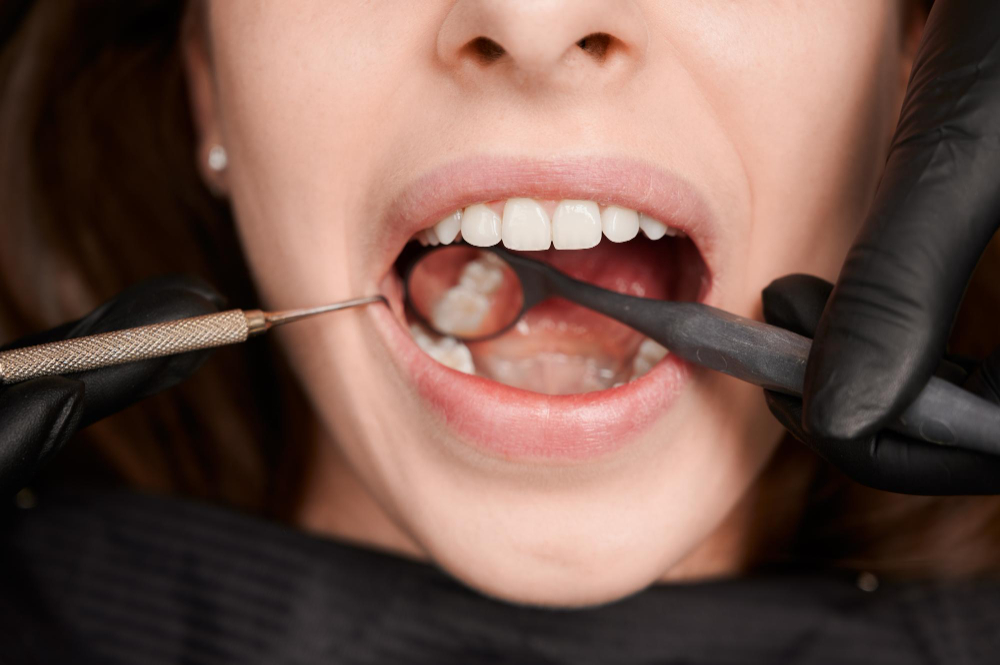 https://clinicaalonsoberrojo.com/wp-content/uploads/2023/06/fotografia-macro-hermosa-sonrisa-femenina-dientes-blancos-sanos-1.jpg