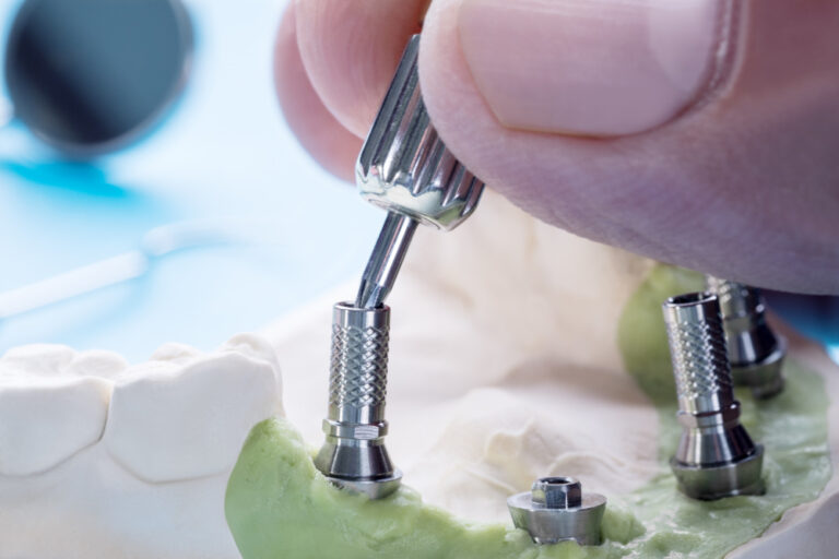 https://clinicaalonsoberrojo.com/wp-content/uploads/2024/03/primer-plano-componentes-pilar-convertibles-pilar-temporal-implante-dental-tornillo-pilar-1-768x512.jpg